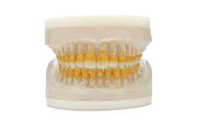 Refil Top Periodontia AC104 - Pronew